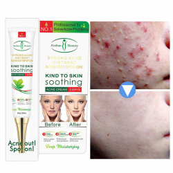 Концентрированный крем от прыщей (против акне) с солями Мертвого моря Kind to Skin Soothing acne cre