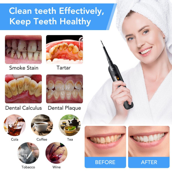 Портативный ультразвуковой прибор для чистки зубного камня со сменными насадками Home-Use Dental Tools (3 насадки, 5 режимов работы)
