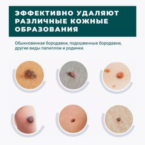 Патчи для удаления папиллом родинок 144 шт. / Пластырь